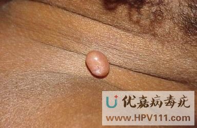 ʲô�Ǵ�Ⱦ������