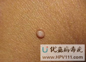 ��Ⱦ���������Բ���