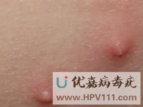 ��ͯ��Ⱦ������