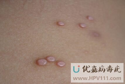 ��Ⱦ���������ȥ��