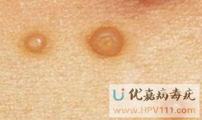 ������ƴ�Ⱦ������