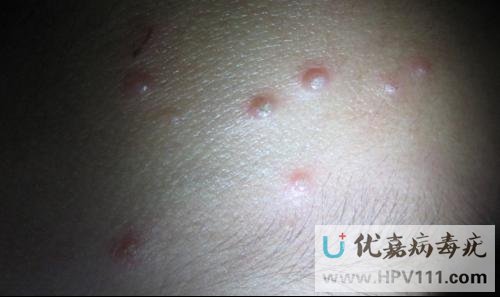 ��Ⱦ��������ʳ