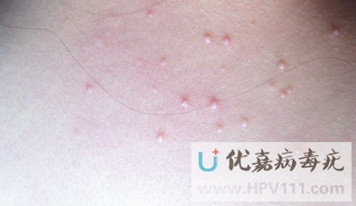 ����ȥ����Ⱦ������