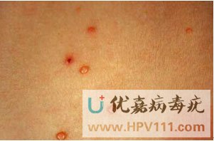 ��Ⱦ������ֱ�Ӱγ�����