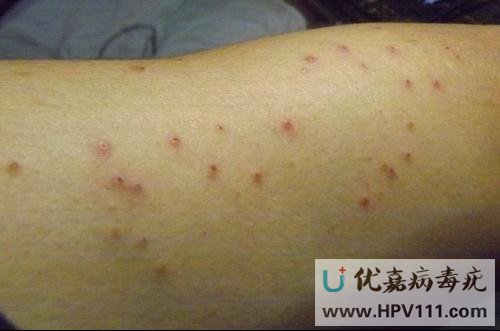 ��Ⱦ�����໯ŧ��ô��