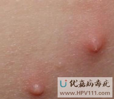 �������ƴ�Ⱦ������