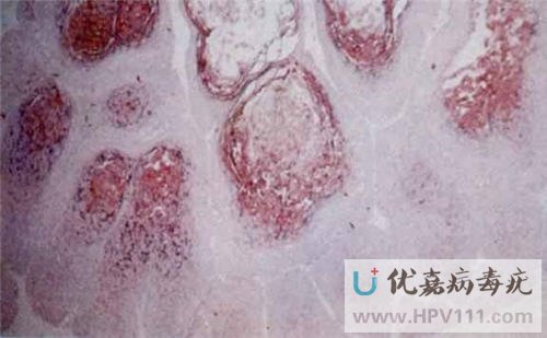 �۾���Ⱦ��������ô��?