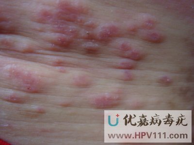 ��Ⱦ������̷���Ⱦ��ô��