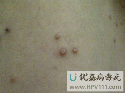 ��ҽ���ƴ�Ⱦ������