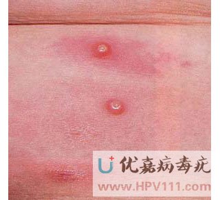 �۲���Ⱦ������ͼƬ