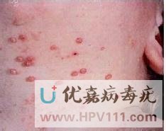 ��Ⱦ���������ܺ�