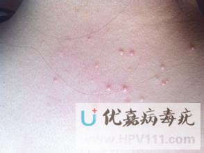 ��Ⱦ��������ô��