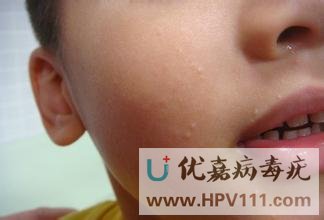 ��Ⱦ��������ʲô