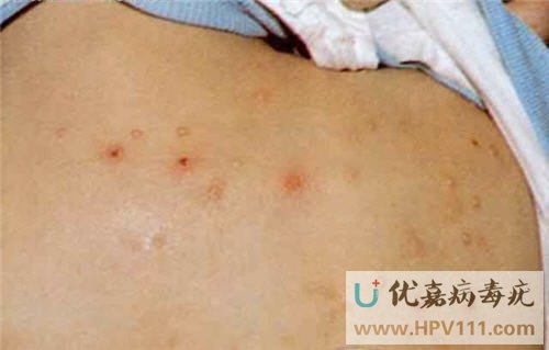 ��Ⱦ�����ഫȾ��