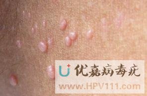 ���ƴ�Ⱦ������