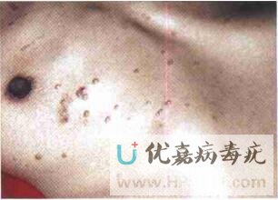 ���̲��鷢��Ⱦ������ 1 ��