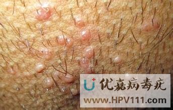 Ƥ����ѧ���ϼ� ��Ⱦ������