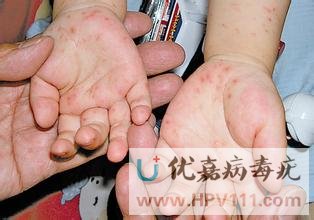 С����Ⱦ��������ʲô