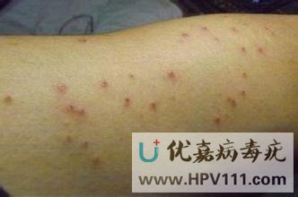 ��Ⱦ��������β��ܼ���Σ��