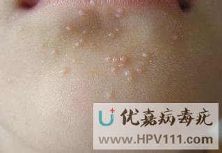 ��Ⱦ���������Ԥ��