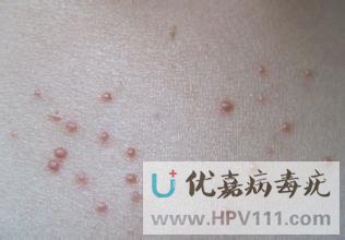 ��Ⱦ������Ͳ���������һ����