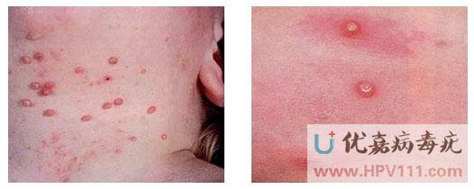 ���Ԥ����Ⱦ����