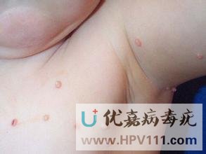 ��Ⱦ��������ôԤ��