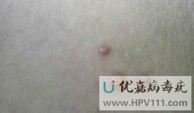 ��Ⱦ�����೤ʲô��