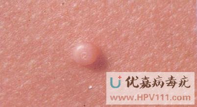 ��Ⱦ����������ҩ