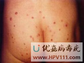 ��Ⱦ��������ϴ����