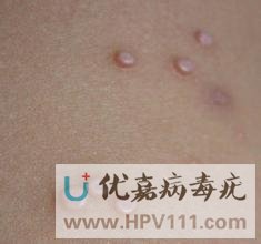 ��Ⱦ������ᴫȾ��