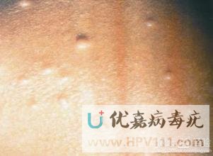 ��Ⱦ������̷���Ⱦ����ô��